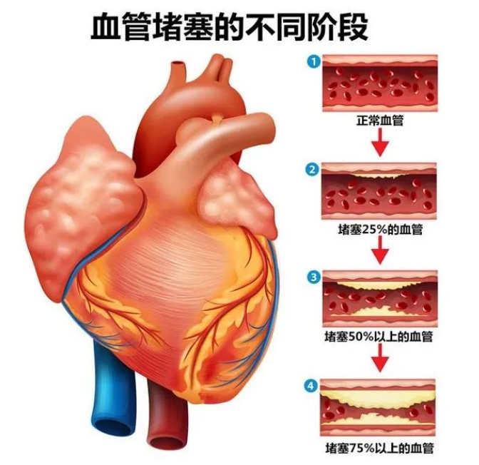 布莱恩特主场失利，降级威胁愈发明显的简单介绍